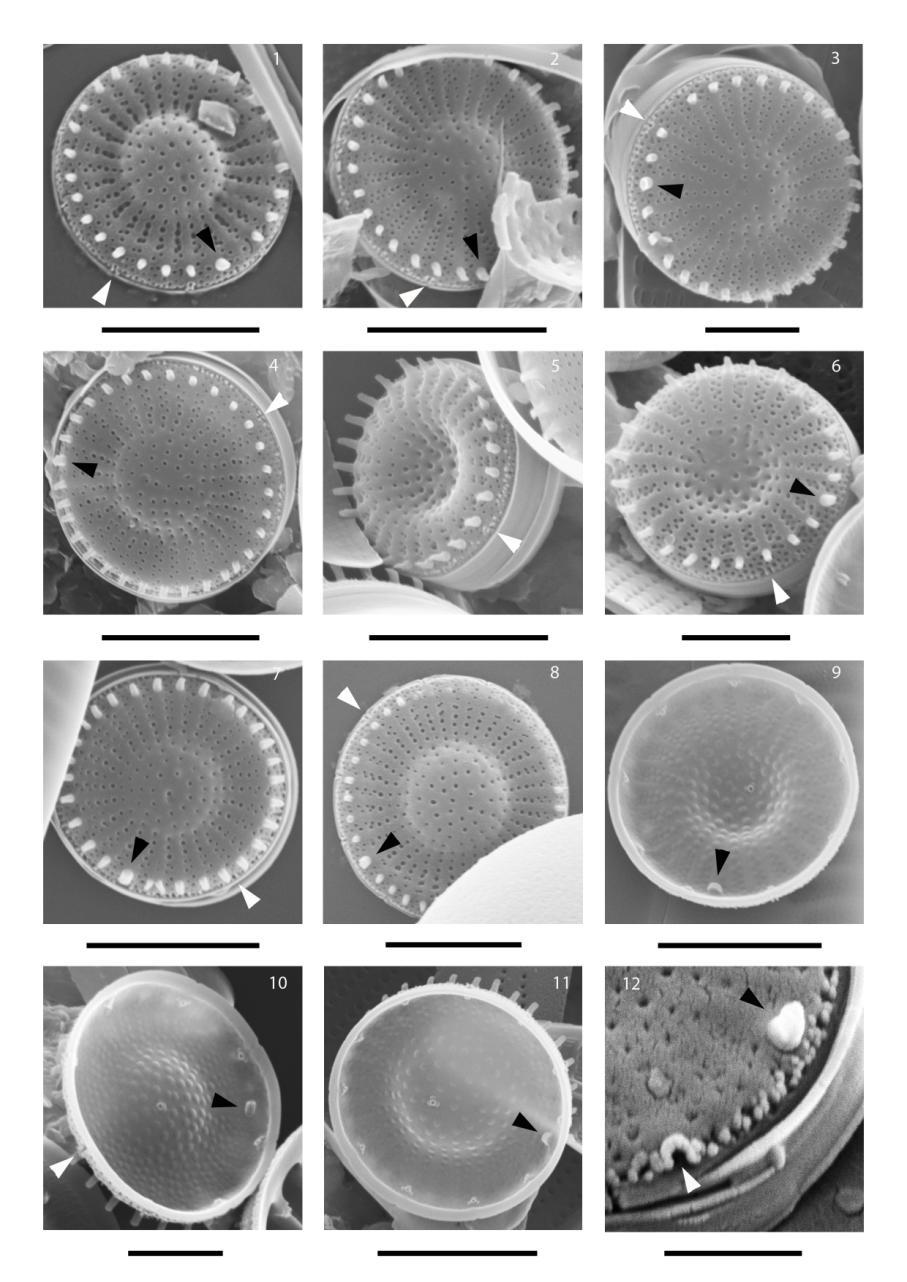 3. ábra: SEM Stephanodiscus vestibulis típusanyag. Skála: 5 µm: 1, 2, 4, 5, 7-9, 11; 2.