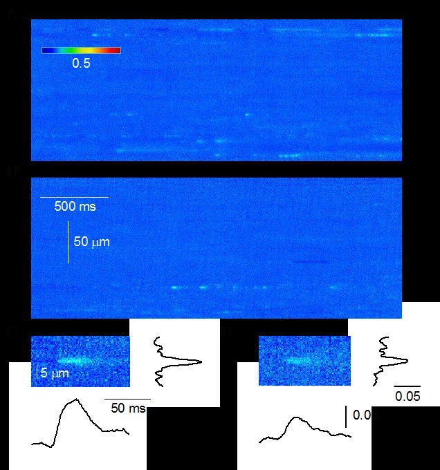 25. ábra Spontán kalciumfelszabadulási események FDB rostokon Kontroll (A) és Cmpt (B) állatokból származó rostokon készült line-scan képek.