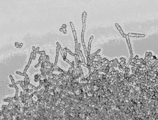 japonicus 7-1 hifa növekedésének kezdeti stádiuma a speciális tárgylemezben. Méretvonal: 10 µm A speciális tárgylemez hosszanti folyosójának térfogata 30 µl.