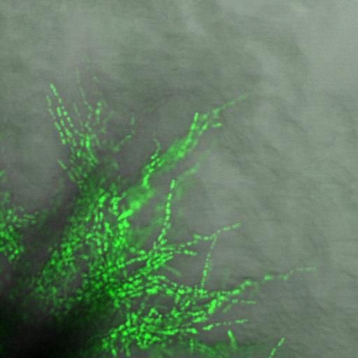 A 15. ábrán meghosszabbodott sejtekben és az agarba fúródó valódi hifákban intenzív fluoreszcens jelet láttunk. A meghosszabbodott sejtekben nem találtuk a poláris, óriás vakuólumokat.