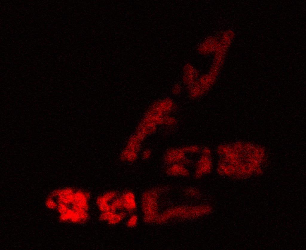 dupla festés. Méretvonal: 5 µm A S.