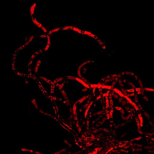 Méretvonal: 25 µm A képen látható, hogy a hifák a hozzáférés nehézségei
