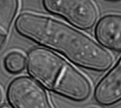 Méretvonalak: (1) 4 µm, (2) 5 µm Az endocitózis a