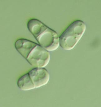 5.5.4. Micéliális mutánsok sejttani jellemzése Az UV mutagenezissel előállított mutánsaink mikroszkópos vizsgálata során 1 több, a myc -- fenotípushoz társuló jellegre lettünk figyelmesek.