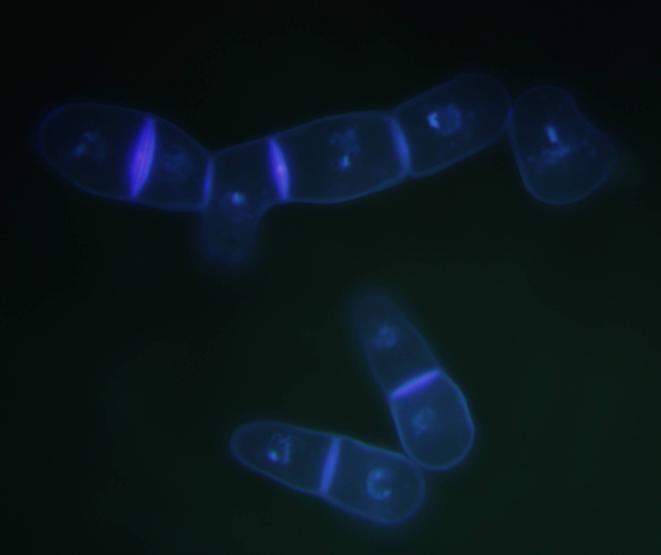 Méretvonalak: 3 µm A mikrohifák esetében kiváncsiak voltunk arra, hogy minden egyes sejt tartalmaz-e sejtmagot, vagy az osztódások után sejtmagot nem örökölt hifatagok