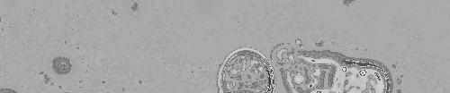 Méretvonal: 5 µm Meg kell jegyeznünk, hogy a kísérleteket természetesen elvégeztük a szülői,