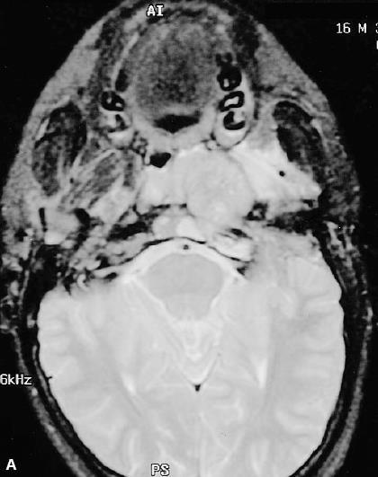 CT MRI