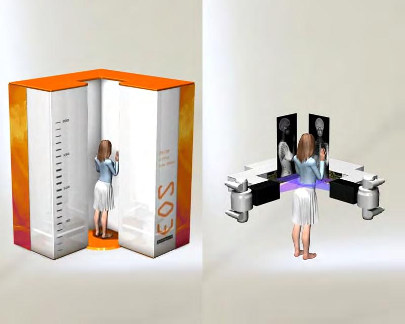 A Charpak-detektor klinikai célra továbbfejlesztett változatát használja az EOS 2D/3D berendezés, amelyben számos technikai újítás is helyet kapott.