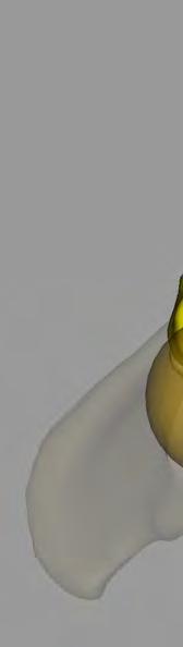 16. Ábra stereos 3D térbeli