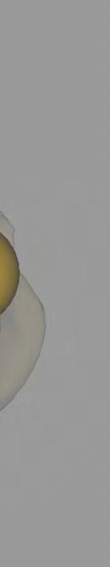 Ábra stereos 3D térbeli rekonstrukció horizontális síkbeli felülnézeti képe időskori degeneratív gerincdeformitás
