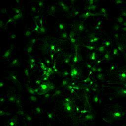 - Ca ++ influx érett gliába: főleg ligand-gated csatornákon: ionotróp glutamát receptor, P2X purinoreceptor - metabotrop receptorok Ca ++ hullám indításában fontosak Glia fiziológia Ca ++ metabotrop