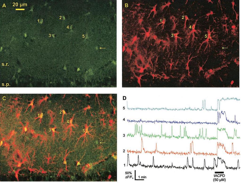 Glia fiziológia Ca ++ waves Spontán calcium oszcillációk asztrocitákban. Hippocampus, CA1. A: Calcium Green AM B: GFAP/S100 immunostaining.