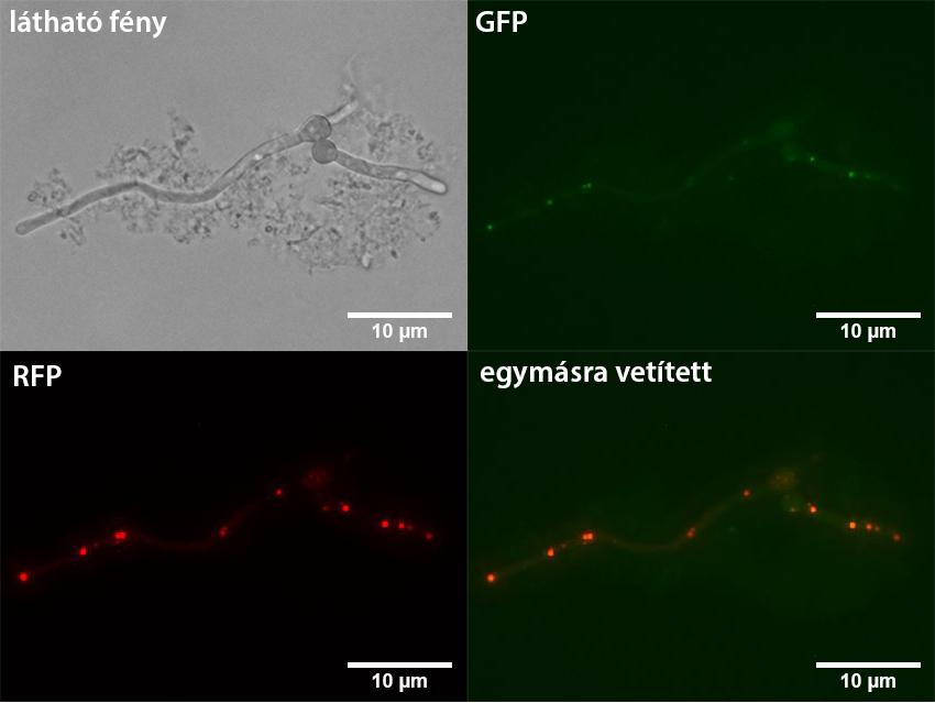 25. ábra: A gfp hxnx fúziós konstrukciót kifejező törzs mikroszkópos vizsgálata. A 6-NA-val és piridoxinnal kiegészített MM tápoldatban felnövesztett HZS.