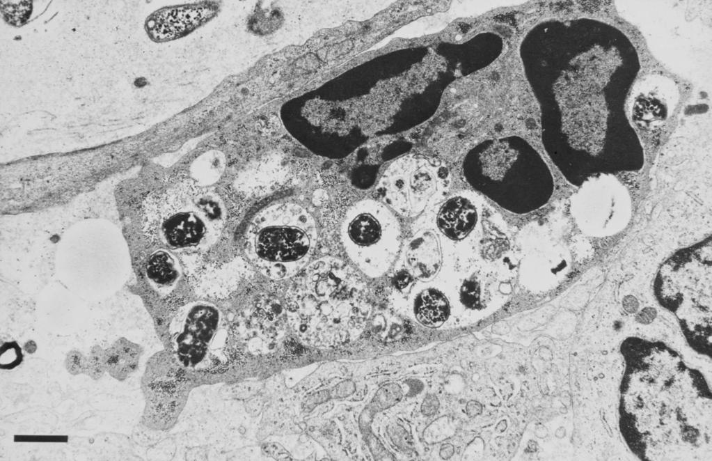 A phagolysosomákban a mieloperoxidáz kloridionok