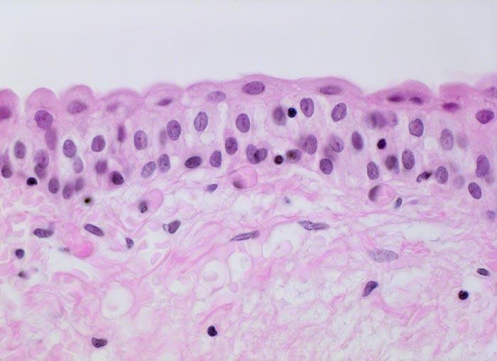 Speciális többrétegű hám: urothelium