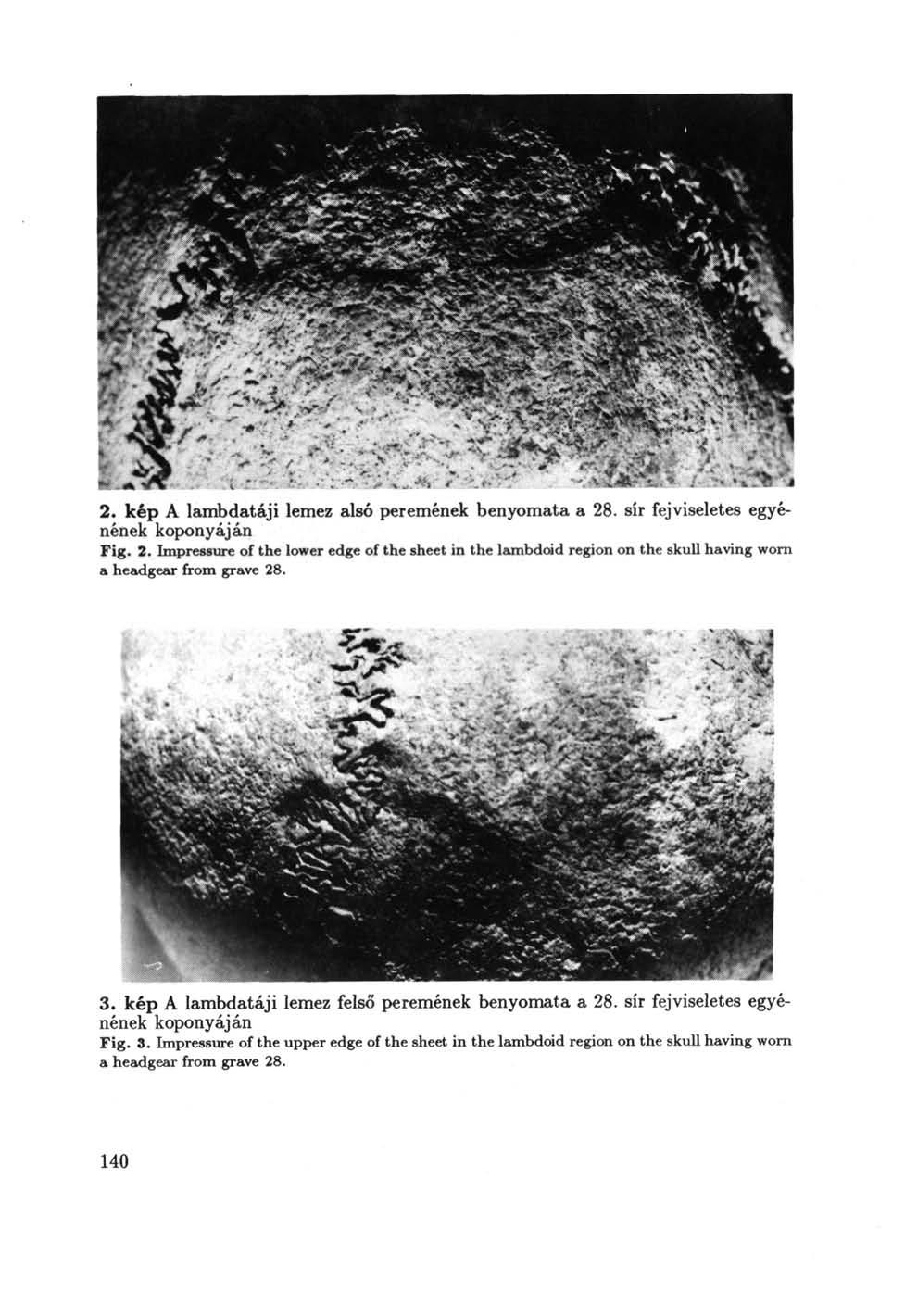 2. kép A lambdatáji lemez alsó peremének benyomata a 28. sír fejviseletes egyénének koponyáján Fig. 2. Impressure of the lower edge of the sheet in the lambdoid region on the skull having worn a headgear from grave 28.