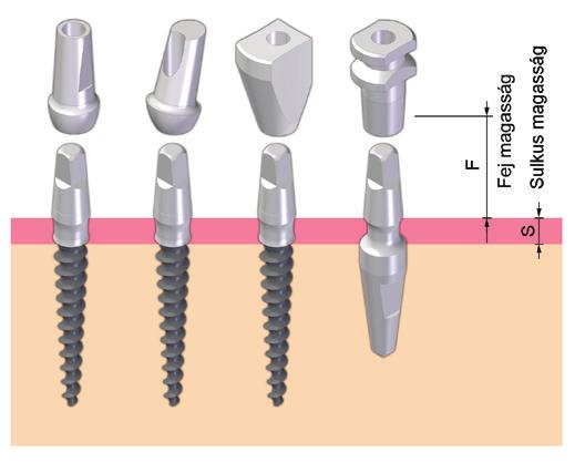 A CONEFIT lim Classic Implantátum Rendszer felépítményei A felépítmények kiválasztásánál figyelemmel kell lenni az implantátum fej formájára.