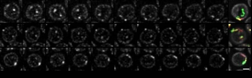 1. ábra. Sejtmag forgolódás a muslica petekezdeményének follikuláris sejtjeiben. Follikuláris sejtek magjainak Importin-β-GFP mintázata 7. stádiumú petekezdeményekben.