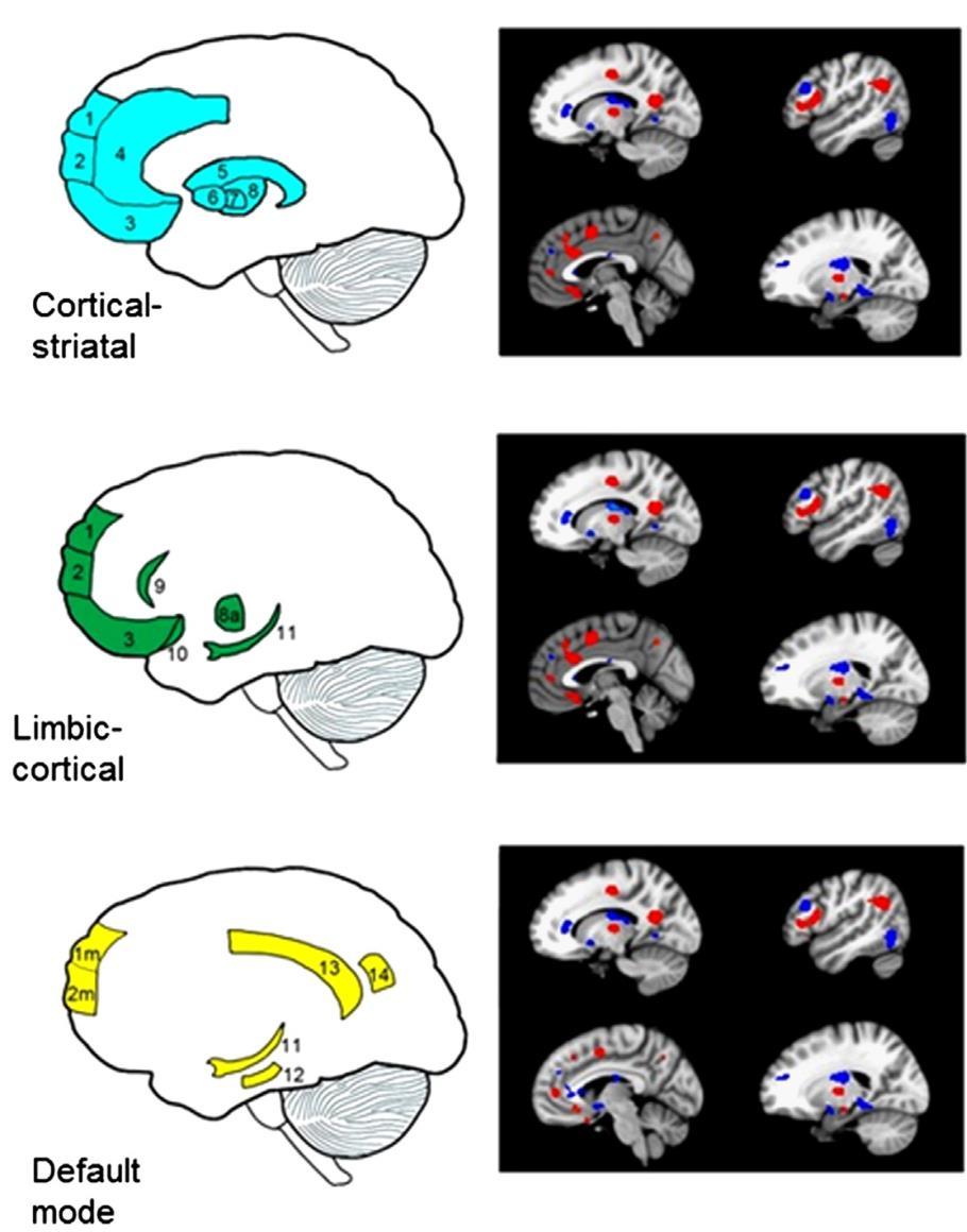 A depresszió fmri anatómiája: eltérő aktivitású lókuszok