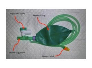 ventilation, apnoeic oxygenation(apox))