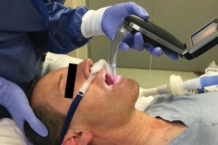 PERoxigenizáció Feltétele: átjárható