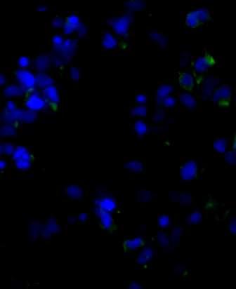 (treated) SLE, n=10; RAR: relative apoptotic ratio; *** p < 0.001; * p < 0.05; n.s.: not significant 1. 2. 1. 2. Figure 5.
