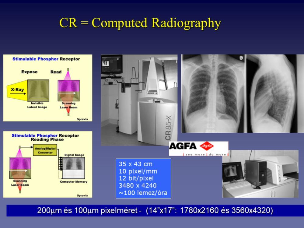 Computed radiography-n az energia tárolásos foszfor lemezes rendszereket értjük. Több, mint 20 éve használják a klinikumban.