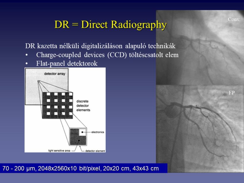 Direct Digital Radiography alatt a kazetta nélküli digitalizáláson alapuló technikákat értjük, jobb képminőséggel, gyorsabb felvételi sebességgel és kisebb mérettel rendelkezik, mint a foszforlemezes