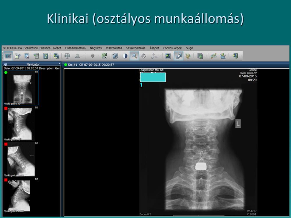 Orvosi munkaállomás, viewing station.