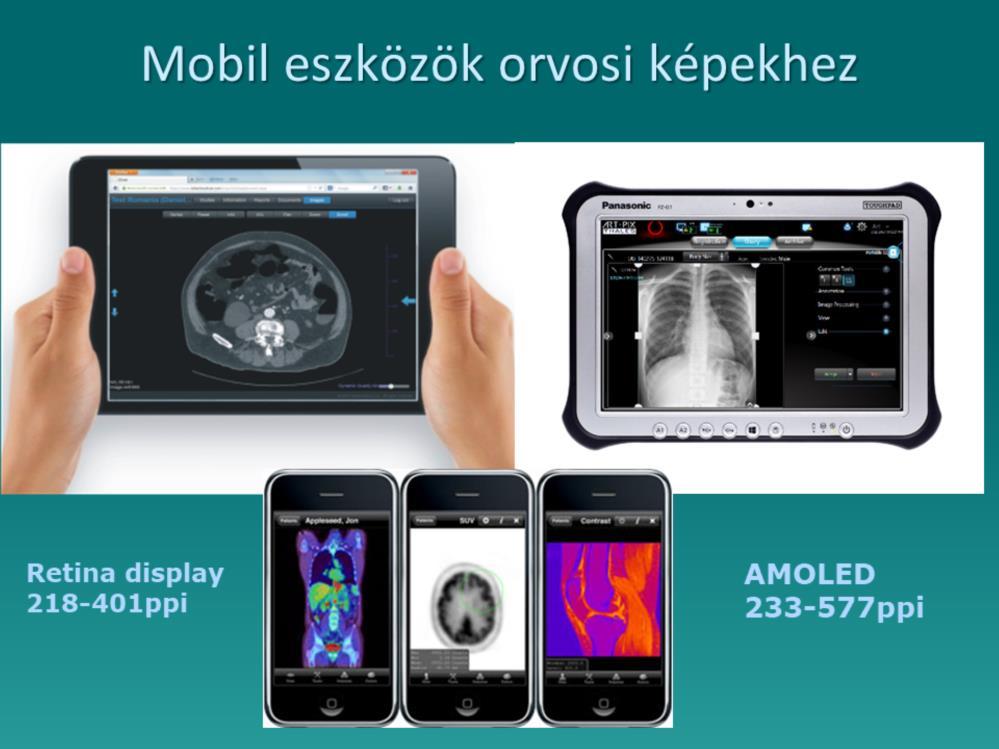 A Retina kijelző pontosan 326 ppi, azaz egy hüvelyk 326 képpont.