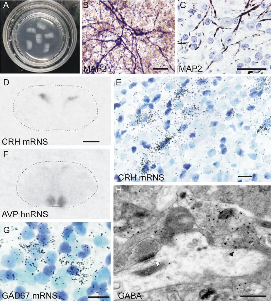 4. ábra. Az organotipikus hypothalamus szelettenyészet vizsgált sejttípusai. A) A szelettenyészetek makroszkópos képe.