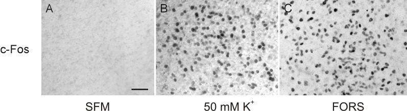 7.1.4. Paraventricularis sejtaktiváció a GABA A -antagonista kezelést követıen a szelettenyészeten A sejtaktivációt a c-fos protein immuncitokémiai kimutatásával követtük.