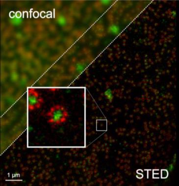 STORM (Stochastic Optical Reconstruction Microscopy) Három kutatócsoport egymástól függetlenül, közel egyidőben publikálta a három módszert, a módszerek alapvetően ugyanazok, csak más típusú próbákat