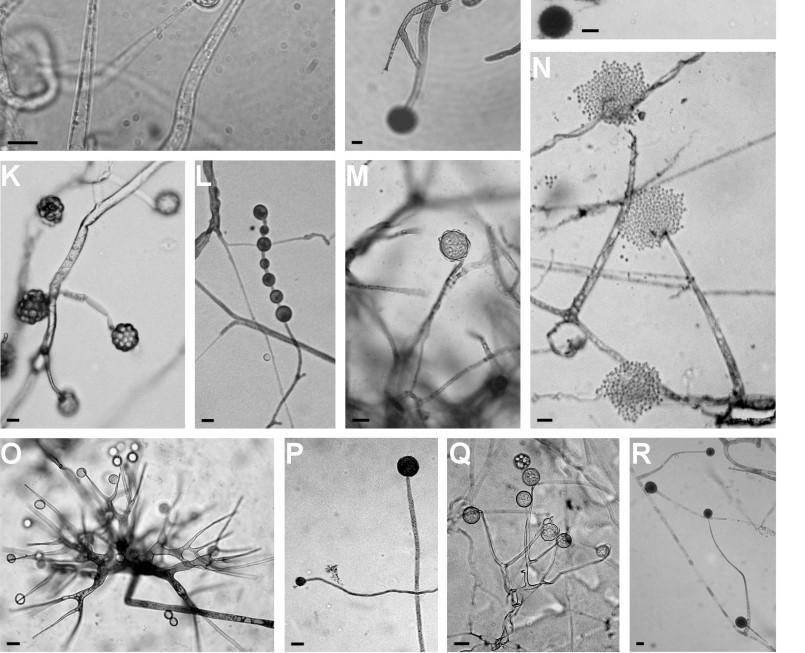 verticillata mikromorfológiája, a nyilak a sporangiofórokat jelzik (B). A M. gemmifera klamidospórája (C). A M. polycephala sporangiumai (D) és sztilospórái (E). A M. polygonia MEA táptalajon képződő sztilospórái (F) és OA táptalajon fejlődött klamidospórái (G).