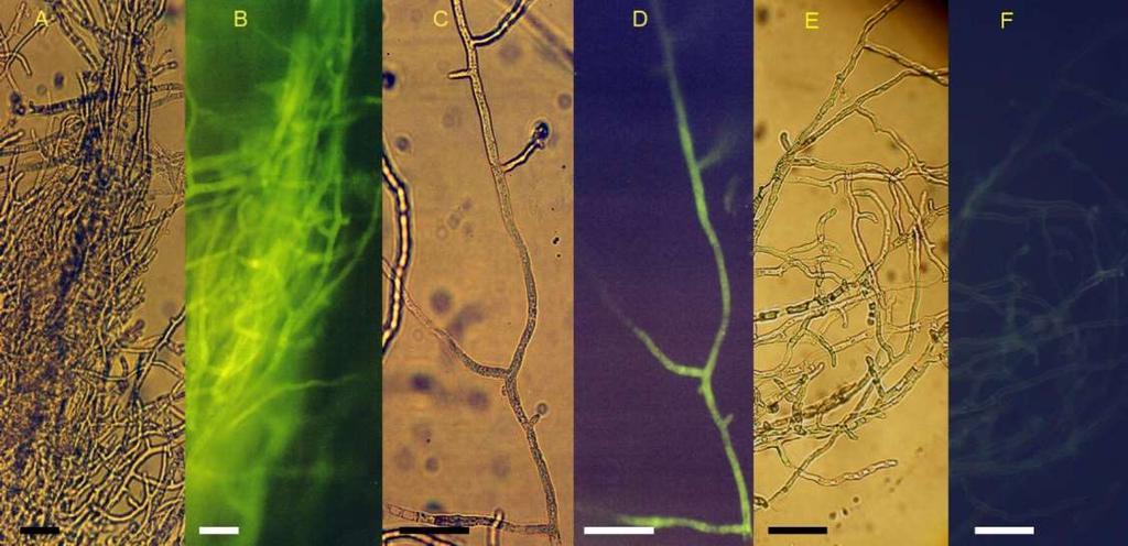Olyan vektorokat is szerkesztettünk, melyek Agrobacterium-közvetítette transzformációra voltak alkalmasak (pca15 és pnyi8; F2. táblázat).