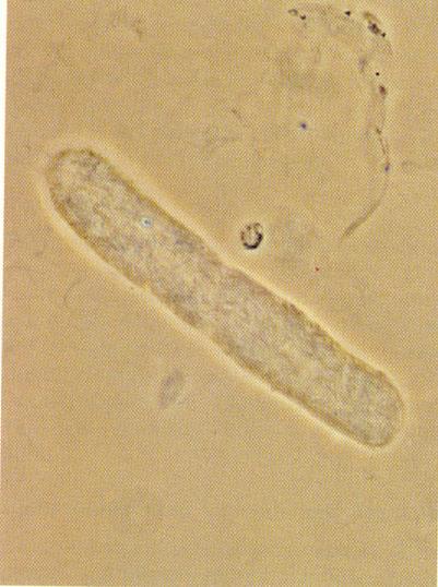 albumin permeabilitás - (vvt+/-)