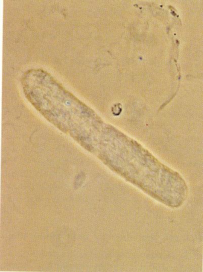 albumin permeabilitás - (vvt+/-)