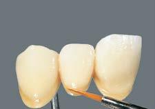 BASIC réteg Formázási javítások fognyaktól kiindulva BASE DENTINE-nel és ENAMEL felvitelével a törzsterületen, egészen az incizális tartományig. Javasolt kiégetés 2. dentinégetés* Vt.