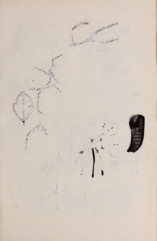 XVIII.