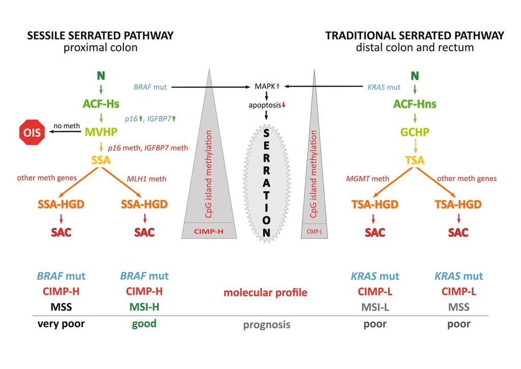 Cpg sziget metiláció Cpg sziget metiláció Szesszilis fogazott útvonal jobb oldali Tradicionális fogazott útvonal bal oldali colon, rectum Nincs met Apoptózis MLH1 met F o g a z o t t s á g MGMT met