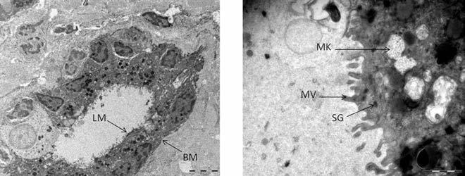 New experimental method to study lacrimal gland ductal epithelia 1. ábra: Izolált, 24 órán át tenyésztett könnymirigy ductus elektronmikroszkópos képe. A: Ductus keresztmetszeti képe.