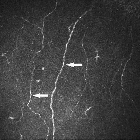 Az epithelium intermedier része esernyő alakú sejtekből áll, amelyek sejthatára és a sötéten ábrázolódó citoplazma közepén a nehezen fellelhető sejtmag világos.