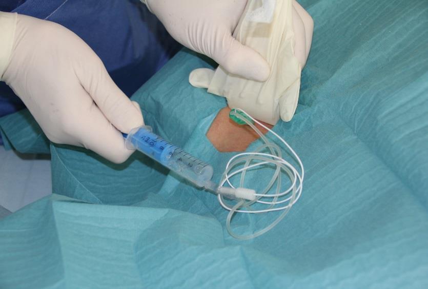 intraoperativ fájdalom kontroll.