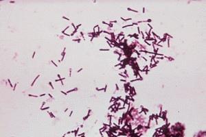 DTPa Torokgyík (Diftéria) Merevgörcs (Tetanusz) Szamárköhögés (Pertussis) Corynebacterium diphtheriae Clostridium tetani