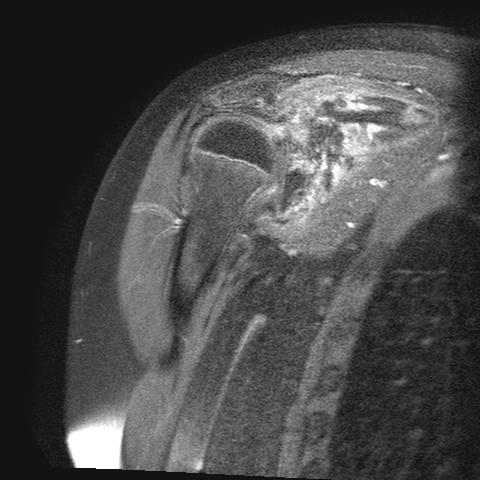 MRI / pre