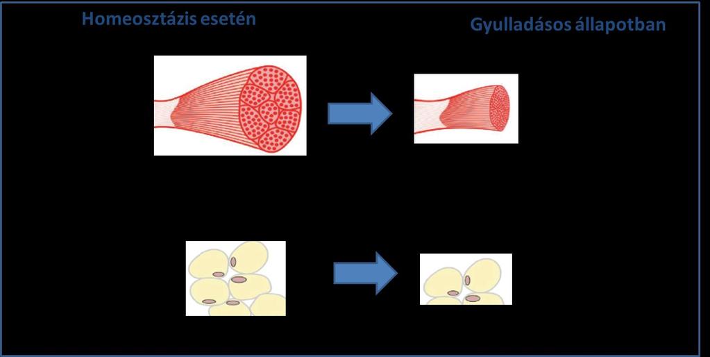 IBD betegségekben a gyulladás olyan patológiás folyamatot indít el, amely az izomfehérje anyagcsere egyensúlyi állapotának felborulásához vezet, azáltal, hogy befolyásolja az izom- és a zsírszövet