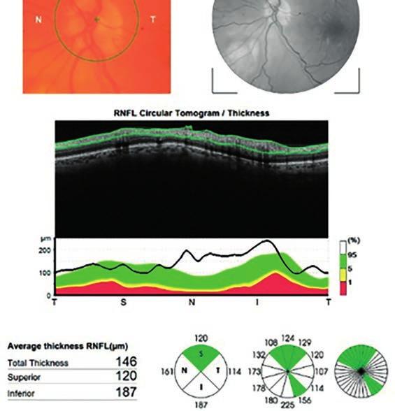 review of the postvaccinal ocular side effects 6.
