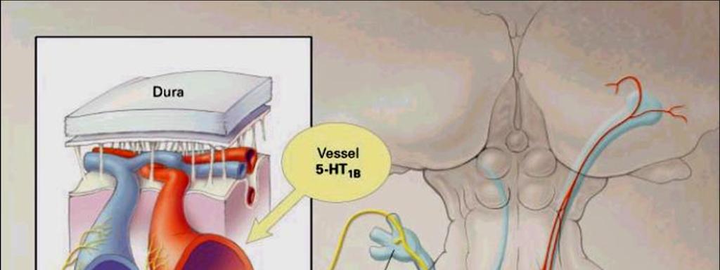 Intrinsic brain activity triggers trigeminal meningeal