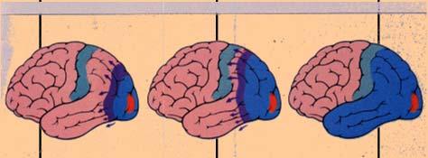 Depression (CSD)