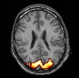 electrophysiológia és